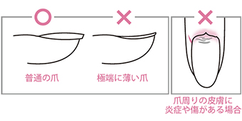 次の方はご使用にならないでください。